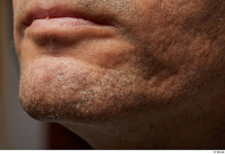  Photos Gabriel Ocampo HD Face skin references lips mouth pores skin texture 0004.jpg